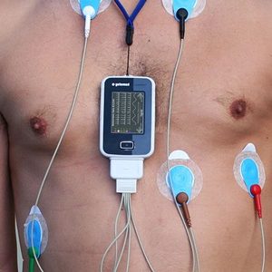 cardiac investigations holter e1465538847326 cardiac investigations holter e1465538847326